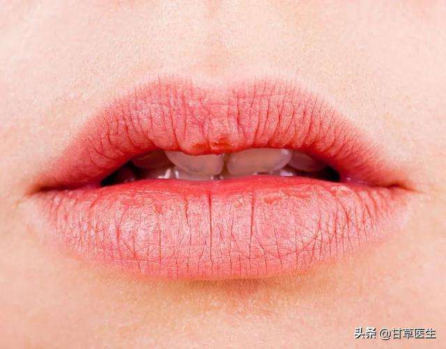 嘴唇的这6种颜色要警惕，是你的身体在报警